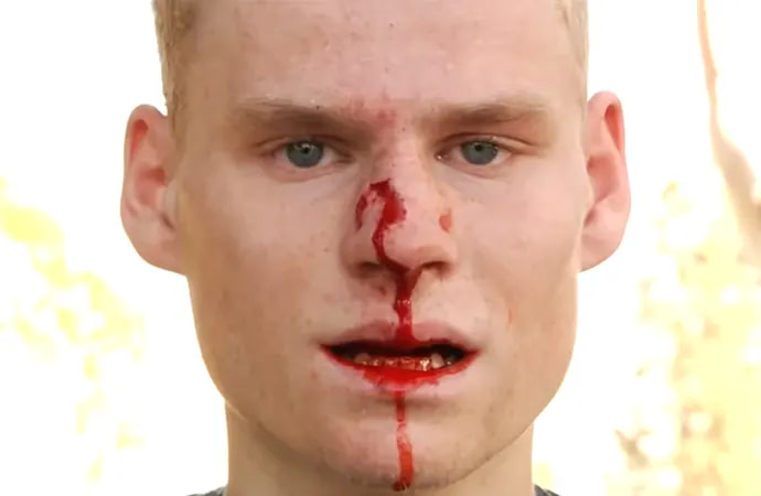 Let's Start How To Prevent Skateboarding Injuries Step By Step